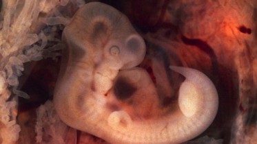 tubal-pregnancy-with-embryo